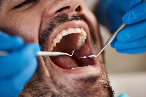 Best Emergency Treatment for Dental Infections or Abscesses in West Chester, PA