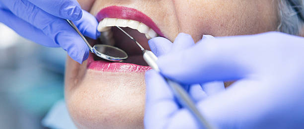 Best Urgent Care for Lost Fillings or Crowns in West Chester, PA